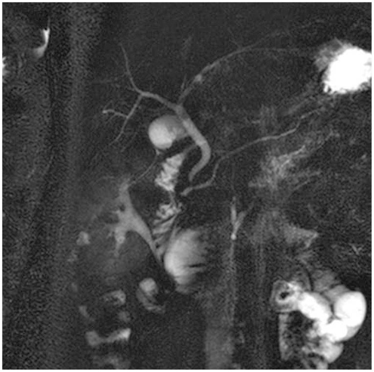 https://cdn.ncbi.nlm.nih.gov/pmc/blobs/e9eb/4260110/455dc49b7e65/ce-47-579-g004.jpg