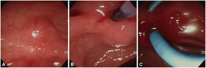 https://cdn.ncbi.nlm.nih.gov/pmc/blobs/e9eb/4260110/e65aff848790/ce-47-579-g005.jpg