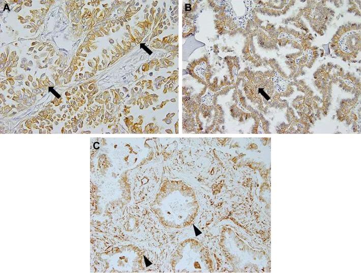 https://cdn.ncbi.nlm.nih.gov/pmc/blobs/e9eb/5679695/6df6d3298385/ott-10-5273Fig1.jpg