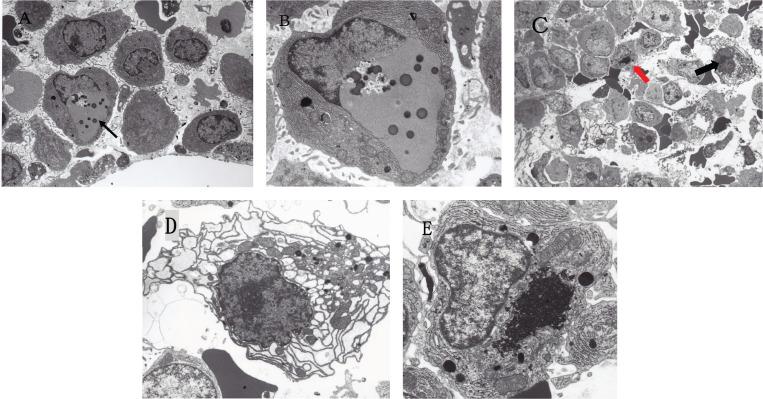 https://cdn.ncbi.nlm.nih.gov/pmc/blobs/e9eb/7498274/a21aa75e2861/can-14-1088fig1.jpg