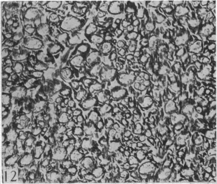 https://cdn.ncbi.nlm.nih.gov/pmc/blobs/e9ed/1393458/38ea4e3af577/jphysiol01500-0153-c.jpg