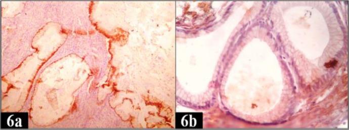 https://cdn.ncbi.nlm.nih.gov/pmc/blobs/e9f4/5929385/2823f248b828/ijp-13-023-g006.jpg