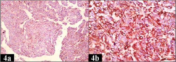 https://cdn.ncbi.nlm.nih.gov/pmc/blobs/e9f4/5929385/8c4c5b83ddff/ijp-13-023-g004.jpg