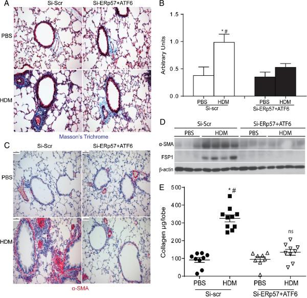 https://cdn.ncbi.nlm.nih.gov/pmc/blobs/e9f5/3877992/0810817bb2f1/1465-9921-14-141-6.jpg