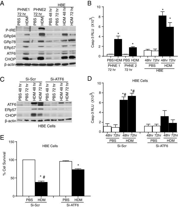 https://cdn.ncbi.nlm.nih.gov/pmc/blobs/e9f5/3877992/92ca1c506ce6/1465-9921-14-141-1.jpg