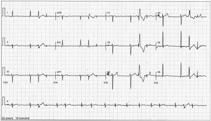 https://cdn.ncbi.nlm.nih.gov/pmc/blobs/e9f5/7890717/5336f0827440/10.1177_1179547621994573-fig3.jpg
