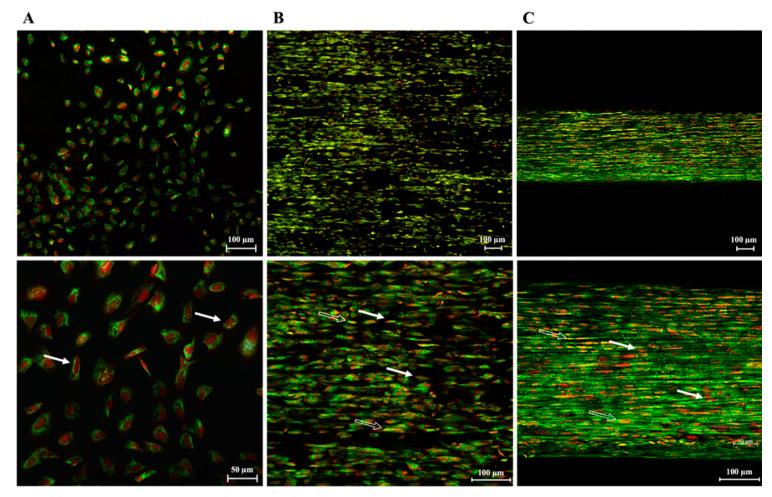 https://cdn.ncbi.nlm.nih.gov/pmc/blobs/e9f7/9599634/3b865df795be/biomedicines-10-02578-g011.jpg