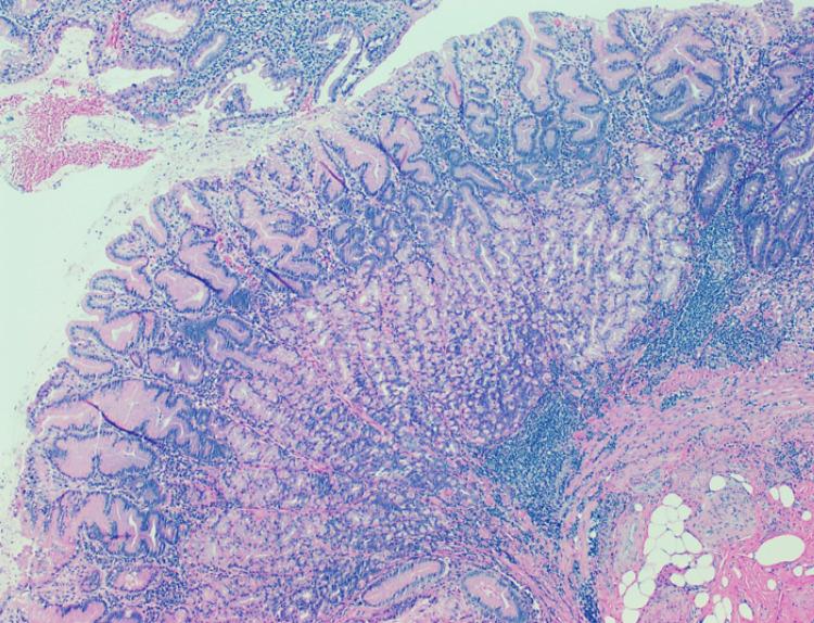 https://cdn.ncbi.nlm.nih.gov/pmc/blobs/e9f8/11801807/7f0ef19bb79b/cureus-0017-00000077092-i03.jpg