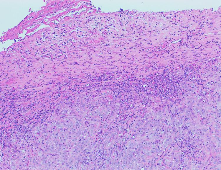 https://cdn.ncbi.nlm.nih.gov/pmc/blobs/e9f8/11801807/ba5f626acc4f/cureus-0017-00000077092-i01.jpg