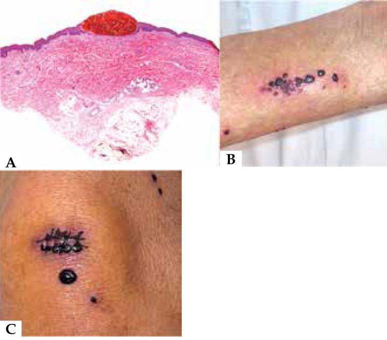 https://cdn.ncbi.nlm.nih.gov/pmc/blobs/e9fc/5193212/da5efdb9dd2f/abd-91-06-0857-g01.jpg