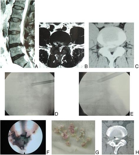 https://cdn.ncbi.nlm.nih.gov/pmc/blobs/ea06/5299691/727ebb7e99b2/13018_2017_524_Fig3_HTML.jpg