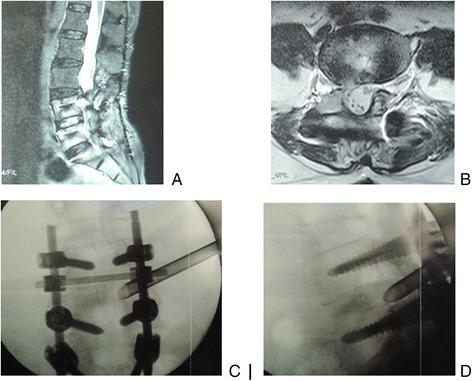 https://cdn.ncbi.nlm.nih.gov/pmc/blobs/ea06/5299691/c503c2a8927d/13018_2017_524_Fig1_HTML.jpg