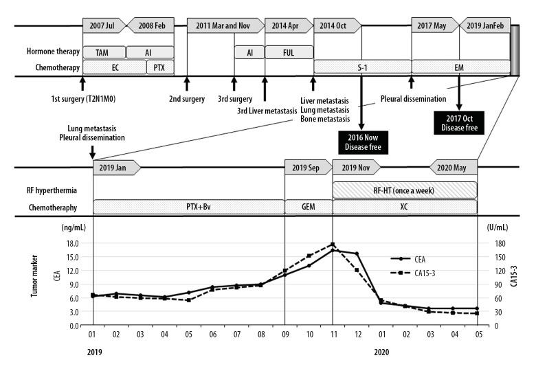 https://cdn.ncbi.nlm.nih.gov/pmc/blobs/ea15/7649113/3e0011307abc/amjcaserep-21-e926647-g005.jpg