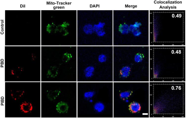 https://cdn.ncbi.nlm.nih.gov/pmc/blobs/ea16/11214800/7a7b8a07d658/IJN-19-6499-g0003.jpg