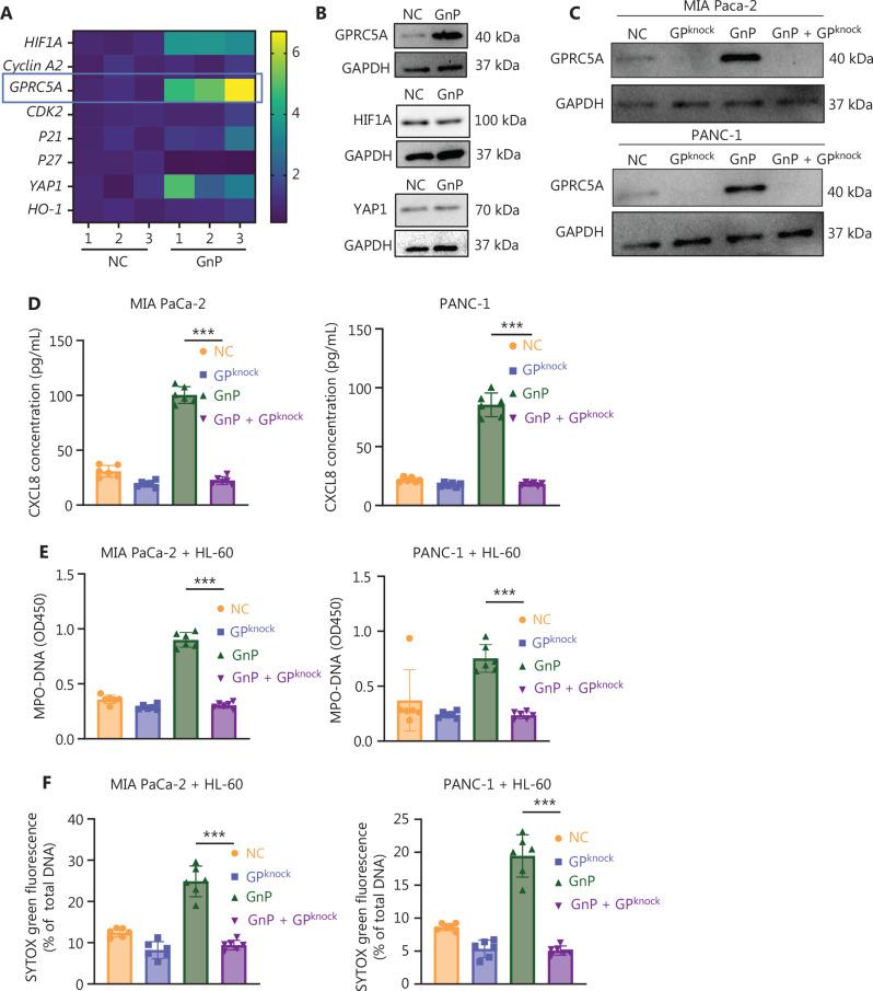 https://cdn.ncbi.nlm.nih.gov/pmc/blobs/ea21/12302273/aa0f0e9b1c4e/cbm-22-07-832-g004a.jpg