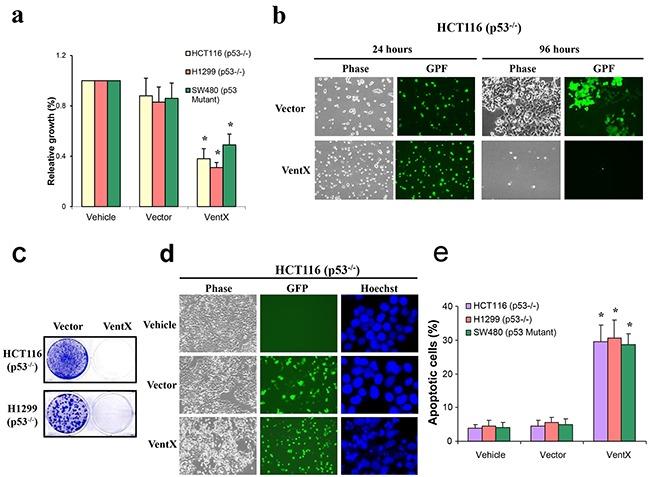 https://cdn.ncbi.nlm.nih.gov/pmc/blobs/ea2b/5129965/06ab02d17310/oncotarget-07-39719-g003.jpg