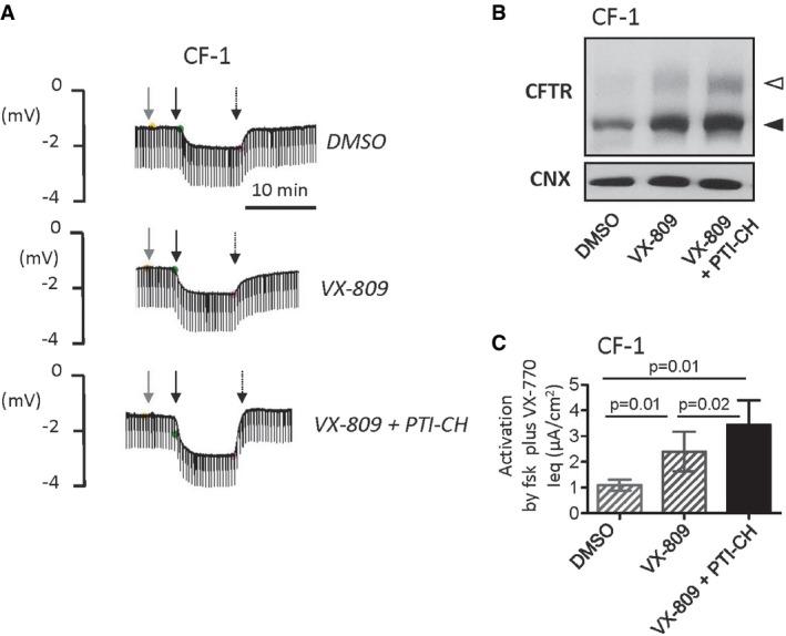 https://cdn.ncbi.nlm.nih.gov/pmc/blobs/ea31/5582412/3c37f1d0d3a6/EMMM-9-1224-g016.jpg