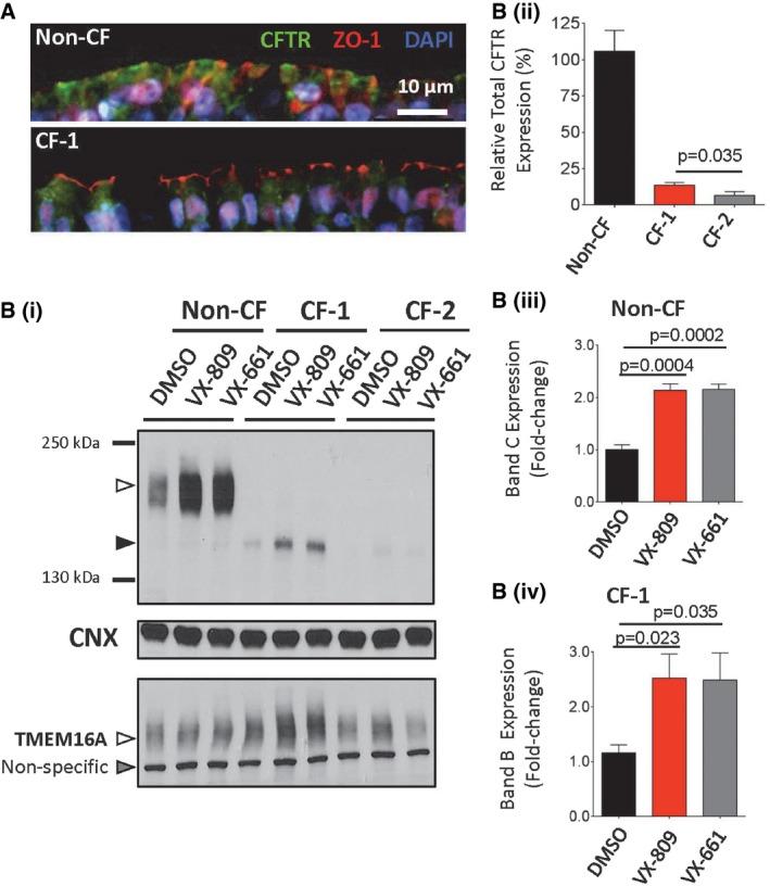 https://cdn.ncbi.nlm.nih.gov/pmc/blobs/ea31/5582412/8886de535087/EMMM-9-1224-g010.jpg