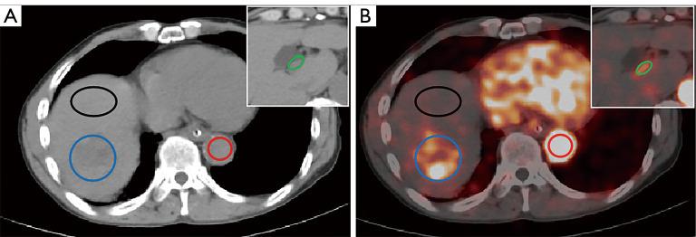 https://cdn.ncbi.nlm.nih.gov/pmc/blobs/ea32/12332710/fad159b662c5/qims-15-08-6654-f1.jpg