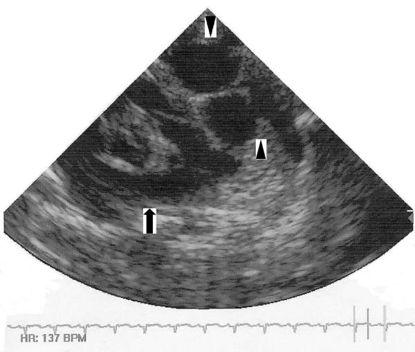 https://cdn.ncbi.nlm.nih.gov/pmc/blobs/ea36/2518156/4e7360866066/1752-1947-2-256-1.jpg