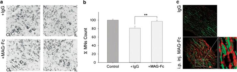 https://cdn.ncbi.nlm.nih.gov/pmc/blobs/ea44/4650434/4cbb3593fbc3/cddis2015228f3.jpg