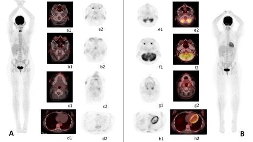 https://cdn.ncbi.nlm.nih.gov/pmc/blobs/ea45/8900565/d2837a69d370/3076_Fig2.jpg