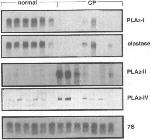 https://cdn.ncbi.nlm.nih.gov/pmc/blobs/ea52/1191239/79fb69525a9a/annsurg00012-0085-a.jpg