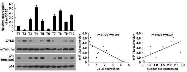 https://cdn.ncbi.nlm.nih.gov/pmc/blobs/ea59/3916099/f082586d481a/1479-5876-12-33-6.jpg
