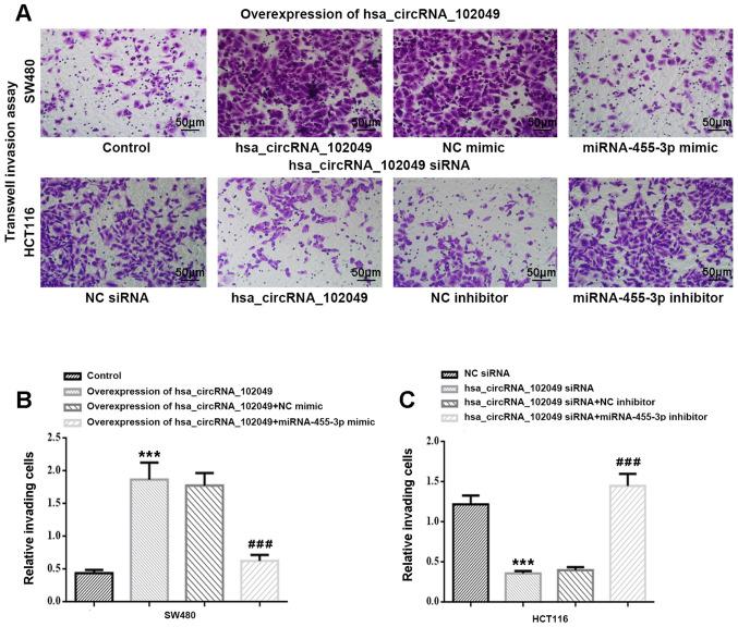 https://cdn.ncbi.nlm.nih.gov/pmc/blobs/ea5a/8815054/bed543a0bd63/etm-23-03-11169-g07.jpg