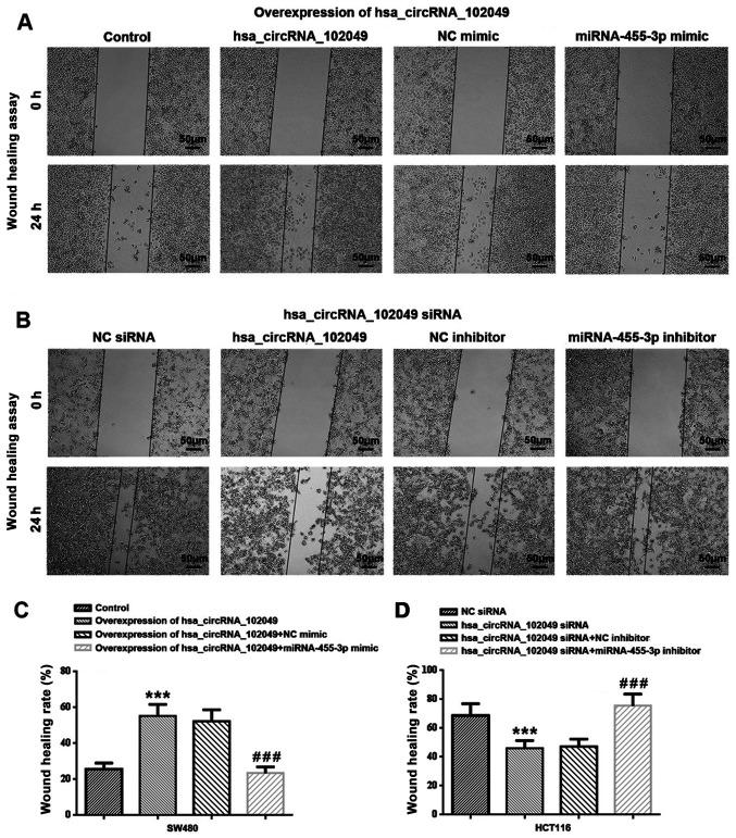 https://cdn.ncbi.nlm.nih.gov/pmc/blobs/ea5a/8815054/c44f2de41dca/etm-23-03-11169-g06.jpg