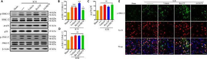 https://cdn.ncbi.nlm.nih.gov/pmc/blobs/ea63/8323669/63f95facb859/NRR-16-1582-g005.jpg