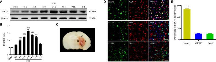 https://cdn.ncbi.nlm.nih.gov/pmc/blobs/ea63/8323669/97857e4a3fba/NRR-16-1582-g002.jpg