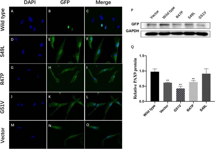 https://cdn.ncbi.nlm.nih.gov/pmc/blobs/ea64/10086135/38a3ae6f98ae/fgene-14-1142776-g004.jpg