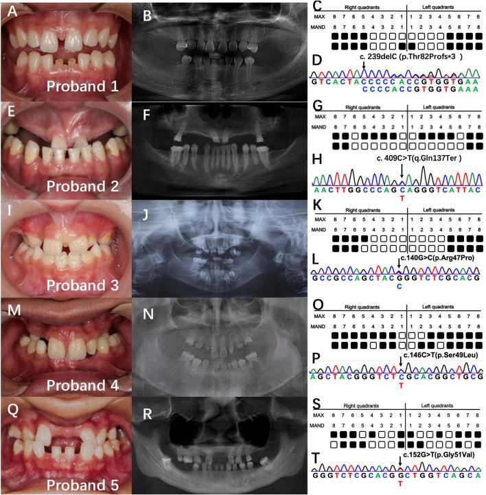https://cdn.ncbi.nlm.nih.gov/pmc/blobs/ea64/10086135/b275d9d4049d/fgene-14-1142776-g001.jpg