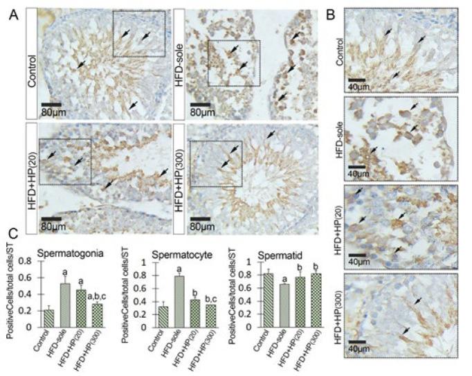 https://cdn.ncbi.nlm.nih.gov/pmc/blobs/ea65/11756727/0164f1738f20/ijbms-28-158-g008.jpg