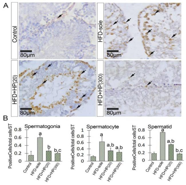 https://cdn.ncbi.nlm.nih.gov/pmc/blobs/ea65/11756727/4503772904a3/ijbms-28-158-g009.jpg
