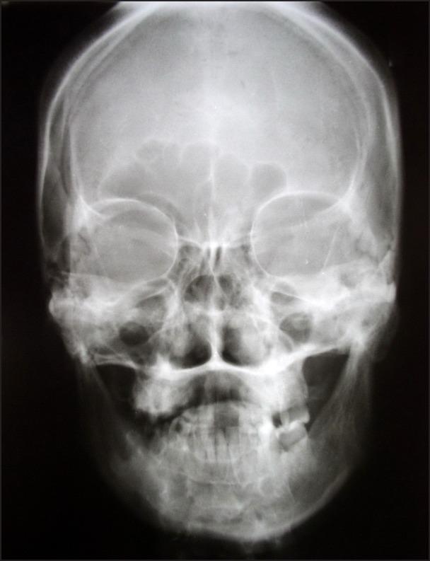 https://cdn.ncbi.nlm.nih.gov/pmc/blobs/ea72/3886062/ada5cca398f5/jomr-02-e5-g008.jpg