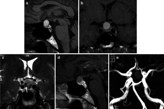 https://cdn.ncbi.nlm.nih.gov/pmc/blobs/ea77/4263799/396bef6d623d/13244_2014_362_Fig6_HTML.jpg