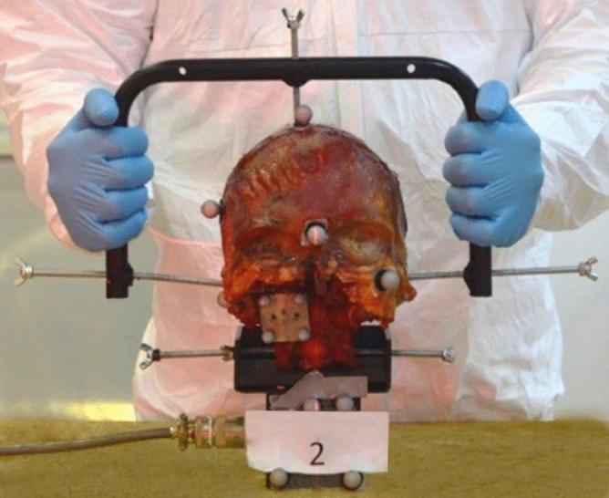 https://cdn.ncbi.nlm.nih.gov/pmc/blobs/ea7e/8149863/ac75a6e6005f/41598_2021_90052_Fig1_HTML.jpg
