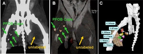 https://cdn.ncbi.nlm.nih.gov/pmc/blobs/ea8a/3925252/606c865ce3a4/1532-429X-16-7-8.jpg