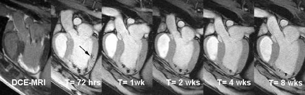 https://cdn.ncbi.nlm.nih.gov/pmc/blobs/ea8a/3925252/d0796938cd43/1532-429X-16-7-4.jpg