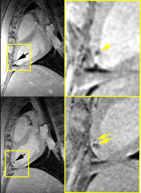 https://cdn.ncbi.nlm.nih.gov/pmc/blobs/ea8a/3925252/d47d055ddbdb/1532-429X-16-7-3.jpg