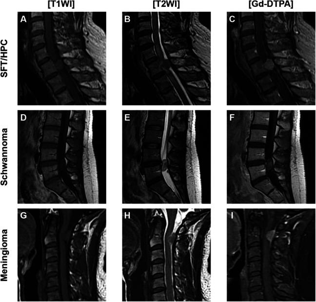 https://cdn.ncbi.nlm.nih.gov/pmc/blobs/ea8c/9972268/c5cb72baaaef/10.1177_2192568221994799-fig1.jpg