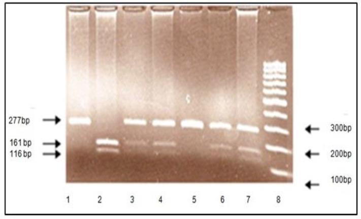 https://cdn.ncbi.nlm.nih.gov/pmc/blobs/ea97/5139949/03c1ffbe273a/IJPS-11-147-g002.jpg