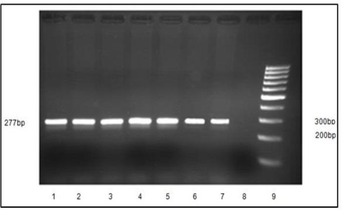 https://cdn.ncbi.nlm.nih.gov/pmc/blobs/ea97/5139949/e1c07db2a867/IJPS-11-147-g001.jpg
