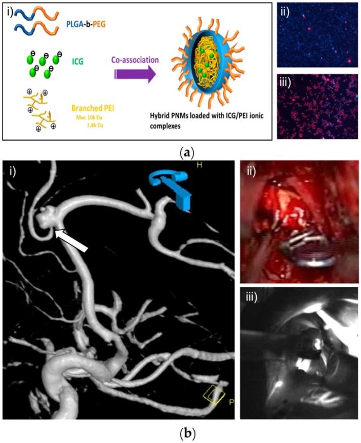 https://cdn.ncbi.nlm.nih.gov/pmc/blobs/ea9d/6027497/d2b23351fce4/nanomaterials-08-00360-g008.jpg