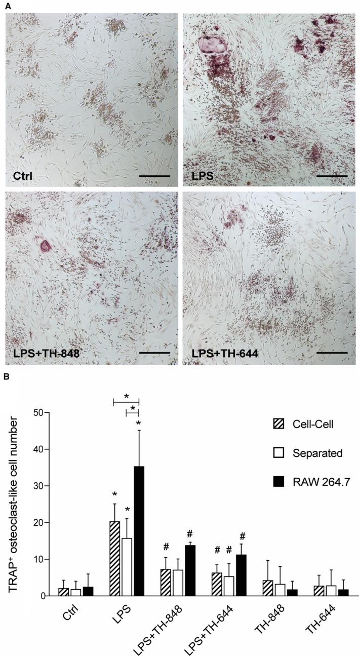 https://cdn.ncbi.nlm.nih.gov/pmc/blobs/ea9e/6349150/633a5639b80b/JCMM-23-1152-g001.jpg