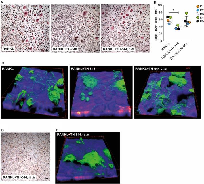 https://cdn.ncbi.nlm.nih.gov/pmc/blobs/ea9e/6349150/fef65cd50b78/JCMM-23-1152-g005.jpg