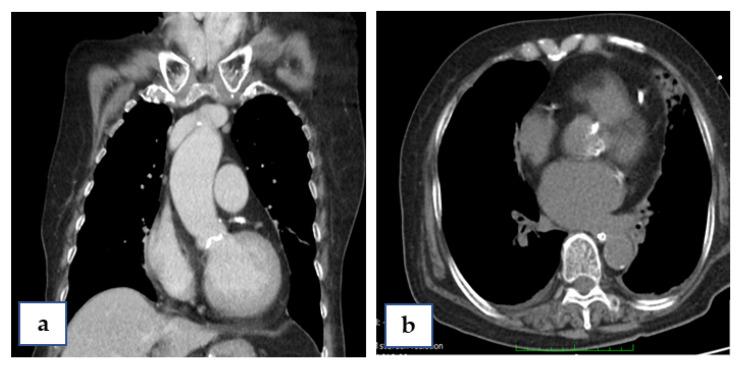 https://cdn.ncbi.nlm.nih.gov/pmc/blobs/eaa3/8953978/daa3bfff3454/medicina-58-00356-g002.jpg