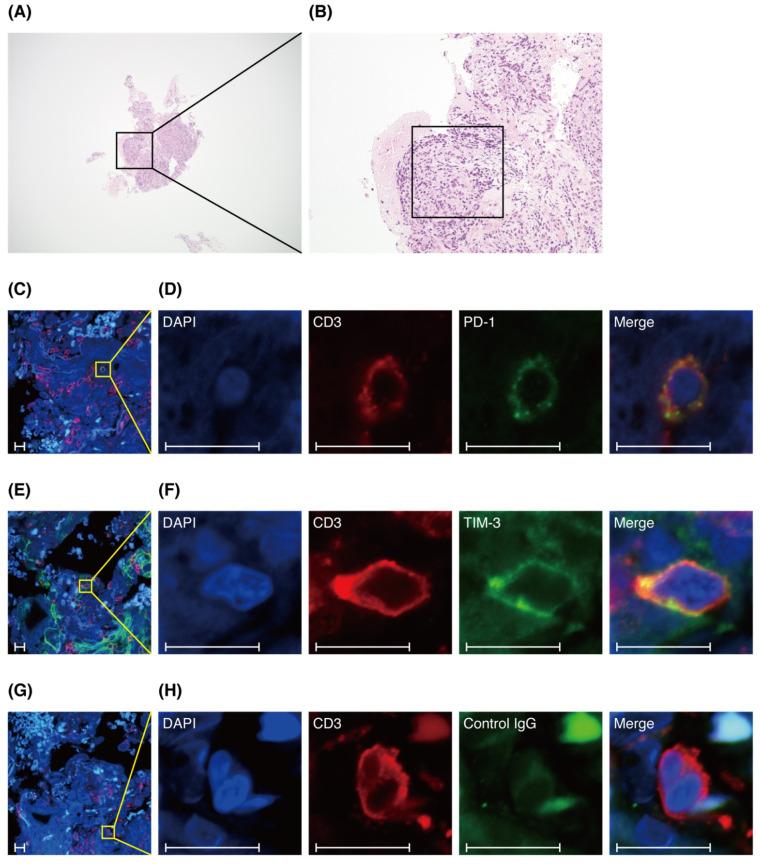 https://cdn.ncbi.nlm.nih.gov/pmc/blobs/eaa5/8471595/804aa3963c4f/biomedicines-09-01231-g004.jpg